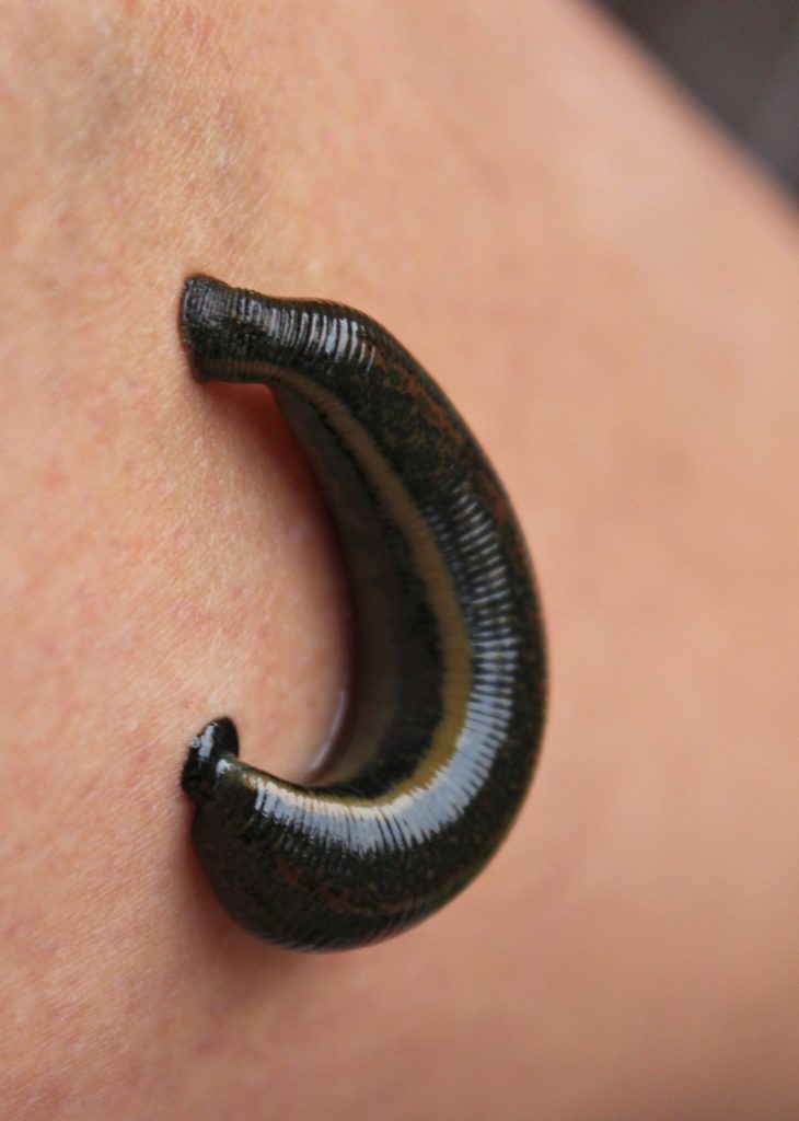 Blutegeltherapie Naturheilpraxis BerlinTegel